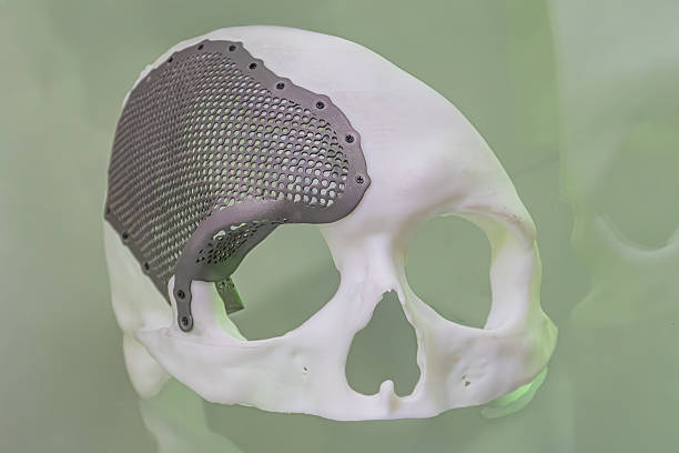 Titanium 3D printing